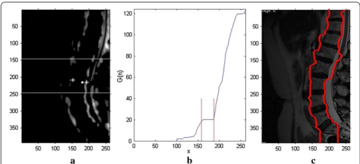 Fig. 3a. Third, the left and right spinal edges are obtained by searching the correspond-ing region from above the centers of left or right spinal edges to both sides, respectively