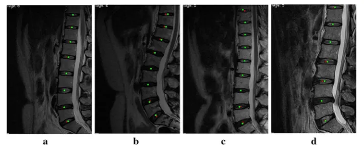 Fig. 6 Comparison of the localization results of our method and the manual method. The the results of the manual method, and the cases including normal patient, herniation and IVD degeneration, different intensity and interference, and red squares are gree