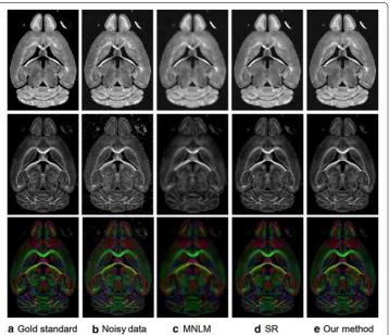 Fig. 4 Quantitative comparison of different denoising methods. a–d are the fractional anisotropy errors of noisy data and denoising results using MNLM, SR and our proposed method