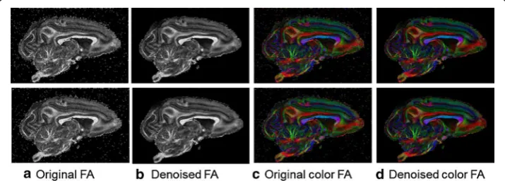 Fig. 6 FA maps of the denoising results for real datasets. The first and second rows are the denoising results for DTI datasets with b values of 1931 and 3091 respectively