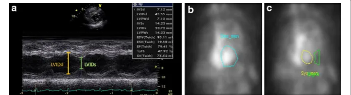 Fig. 1 An example of LVEF estimation based on a the LVIDs and the LVIDd using ECHO b EDV and c ESV using MUGA LVEF and MUGA MI