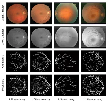 Fig. 4 Best and worst accuracy cases for the DRIVE and STARE database. tiff, accuracy 0.9606; im0291.ppm, accuracy 0.9724; a Best accuracy case, image 10_test.b Worst accuracy case, image 13_test.tiff, accuracy 0.9406; c Best accuracy case, image d Worst accuracy case, image im0240.ppm, accuracy 0.9336