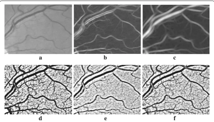 Fig. 7 Preprocessing examples: a random patch from 01_test.tif. effects from [a Green channel, b, c two Gabor filter 35], d processed by MMSDG, e processed by ICGF, f fusion effects
