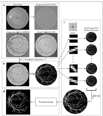 Fig. 1 Functional diagram of the proposed method. filters; a image enhancement; b preprocessing; c elongating d post-processing