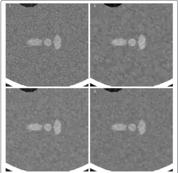 Figure 5 Filtering of a synthetic image: comparison with ADFsadded. (b-d) The images filtered by the proposed method, Perona-Malik ADF, and Weickert