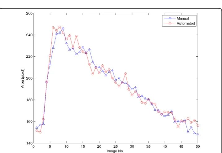 Figure 4 Results of the carotid artery boundary detectiondynamic programming. D. Results of circle model guided dynamic programming