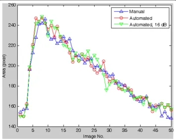 Figure 9 The comparison (signed and unsigned relative error) between manual drawing andautomated method applied on different noise degraded images