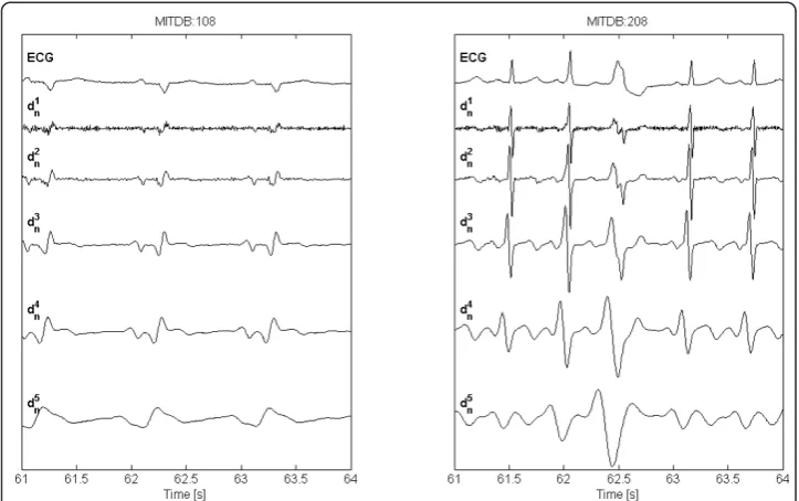 Figure 4 ECG signal and DWT decomposition. Examples of ECG signals from MITDB records (resampledat Fs = 250 samples/s) MITDB:108 (left), MITDB:208 (right), and DWT detail coefficient dkn at scales 21through 25.