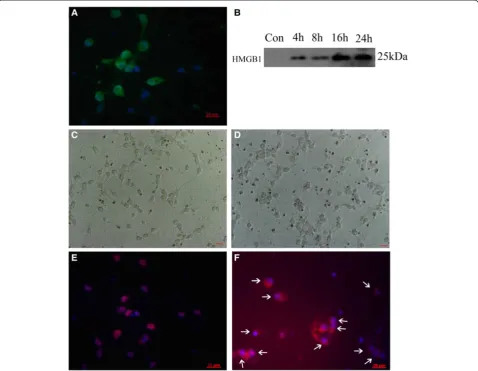 Figure 10 Representative photomicrographs showed brain neurons double immunofluorescent staining for High-mobility group box 1(HMGB1) (red) and Neuron-specific nuclear protein (NeuN), a neuronal cell marker (green) in vitro in the control (C, E) and Hb inc