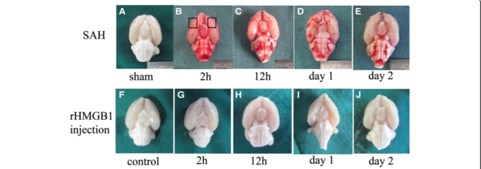 Figure 1 Schematic observation of the brain after surgery.onset. Rat brains in the sham group were harvested one day after the surgical proceduresubarachnoid space gradually disappeared with time Top: rat brains harvested at different times after subarachn