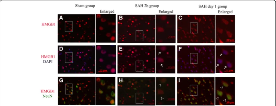 Figure 3 Cytosolic expression of high-mobility group box 1 (HMGB1) in Neuron-specific nuclear protein(NeuN)-positive cells of cortexnuclear staining (blue).right side of each panel highlight the increased number of NeuN-positive cells with cytosolic staini