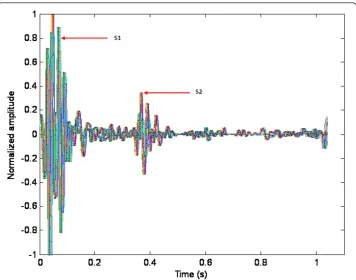 Figure 3 Superimposed and truncated heart beats of the pre-recorded stethoscope test signal