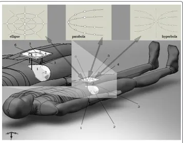 Figure 5 Schematic representation of the electrodes insertion in clinical studiesalong of the deep tumor and distributed according to the conical section type (ellipse, parabola andhyperbola)