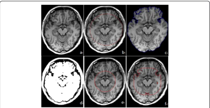 Figure 1 Results comparison of different initial contour. Figure. 1. (a) The original MR image