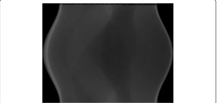Figure 2 Shepp-Logan phantom. (a) the original image, (b) the gradient counterpart of (a).
