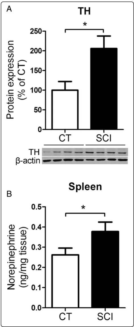 Figure 8 Chronic spinal cord injury (SCI) increases theBar graph represents the mean ± SEM of TH expression in the spleenprotein extract and are expressed as percentage of CT