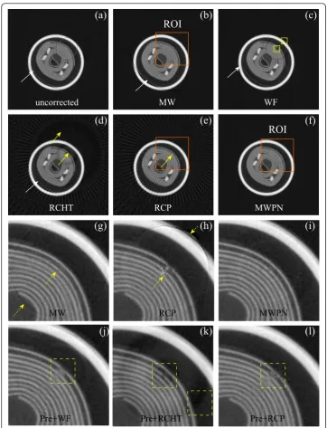 Figure 3 Removal of ring artifacts from an electrolytic capacitor imagethe varying intensity rings are pre-corrected, therefore, the remaining mis-calibration rings are suppressedby these three methods
