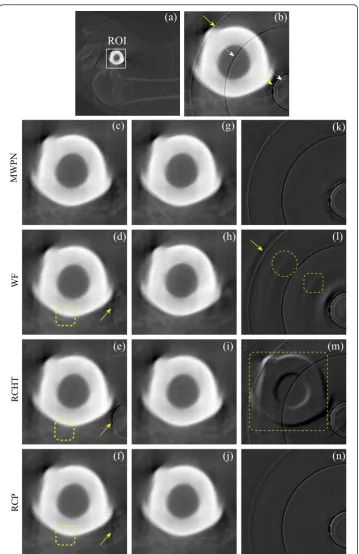 Figure 6 Removal of ring artifacts from a rabbit bone with a metal implant imageand RCP methods applying on the pre-corrected image are displayed in (g-j), respectively