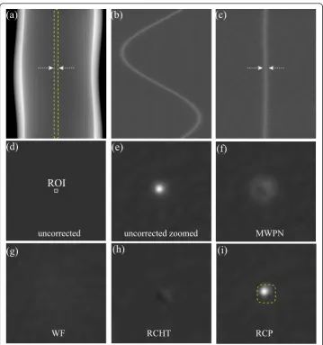 Figure 7 Removal of ring artifacts from a uniform phantom image with a gold wire located at theiso-center