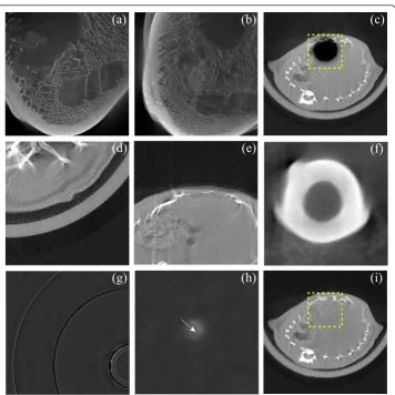 Figure 8 Removal of ring artifacts from the analyzed CT images by applying the SBRC method andeffect of using wavelet-analysis-based method on cone beam CT volume images