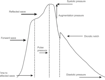 Figure 1 Shape of central BP waveforms.Notes: SBP and DBP are the pick and through of pulse wave