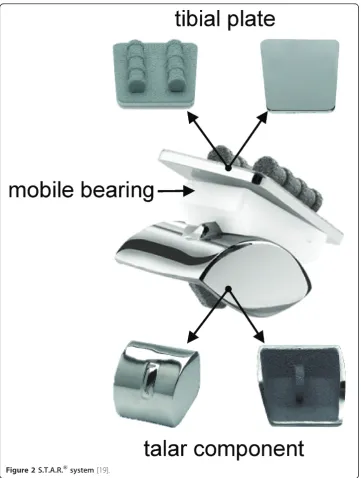 Figure 2 S.T.A.R.® system [19].