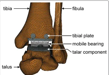 Figure 3 FE solid model of the prosthetic ankle joint.