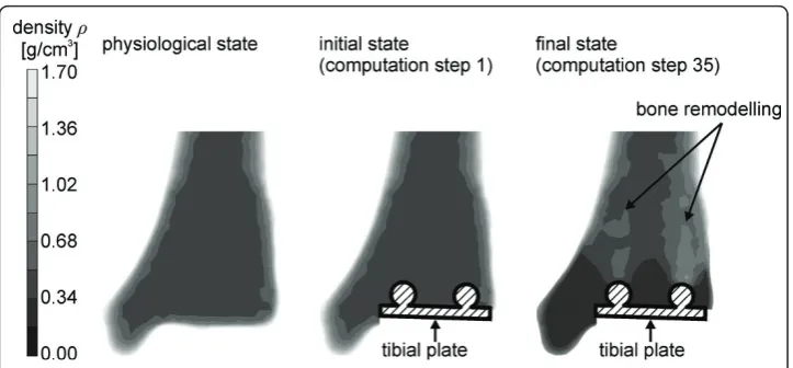 Figure 7 Density distribution in the distal tibiatibia bone remodelling areas can be determined according to the density changes which are exemplarily