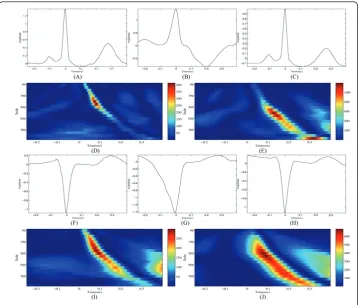 Figure 3 Examples of the analysis of subjects 106 and 207 in the MIT-BIH arrhythmia databaseusing a dedicated wavelet