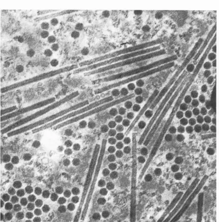 Figure ll. Electron microscope photograph of a mixture of TMV and SBMV. Magnification: 200