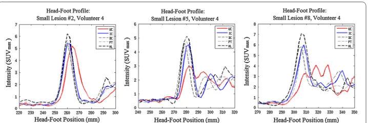 Fig. 5 The effects of motion correction on large lesions in positions 2, 5, and 8 in coronal views of volunteer below PET image resolution