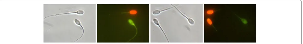 Figure 2 Examples of spermatozoa head images. The first row shows registered greyscale heads and the second row their range filteredoutputs