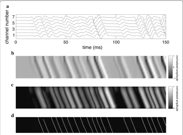 Fig. 1 Steps of the proposed CV estimation algorithm. a 150-ms segment of a 7-channel synthetic S-EMG 