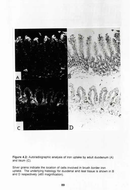 Figure 4.2: Autoradiographic analysis of iron uptake by adult duodenum (A) 