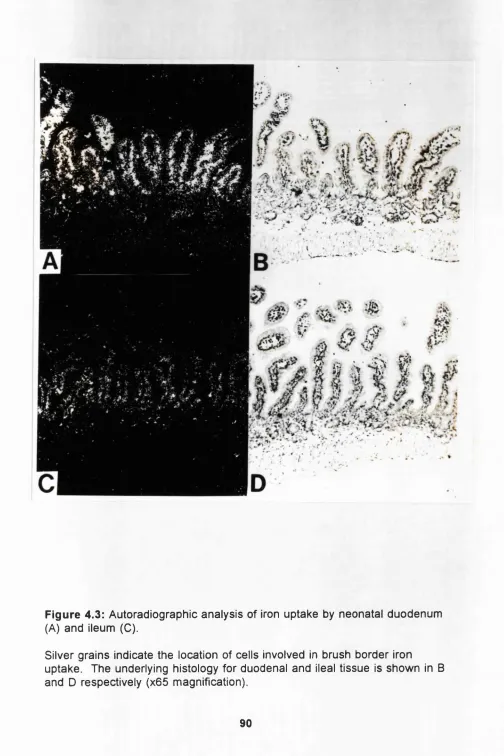 Figure 4.3: Autoradiographic analysis of iron uptake by neonatal duodenum 