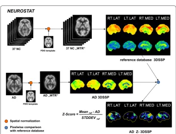 Fig. 2 Workflow of CAD4D software. After spatial normalization, the z‑score image of an AD patient was calculated by voxel‑by‑voxel comparison to the reference database created from healthy subjects
