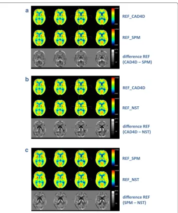 Fig. 4 Comparison of 37 reference datasets (REF): CAD4D or NEUROSTAT (NST), increased (a normalized with CAD4D or SPM, b normalized with c normalized with SPM or NEUROSTAT (NST)