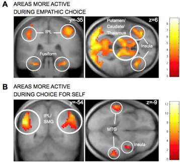 Fig. S4. A) Areas exhibiting higher average (unmodulated) activity during empathic 