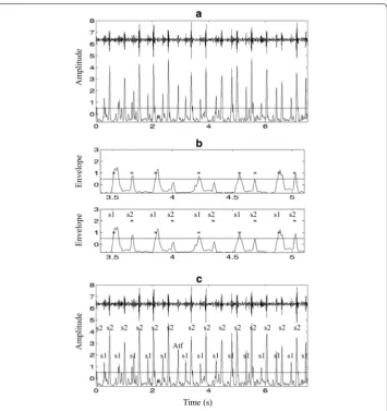 Figure 9 Envelogram based heart sound segmentation a original signal and its average Shannon energy, brecovering the “lost” peaks, and c identified S1 and S2 and artifacts.