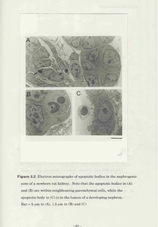 Figure Electron micrographs of apoptotic bodies in the nephrogenic