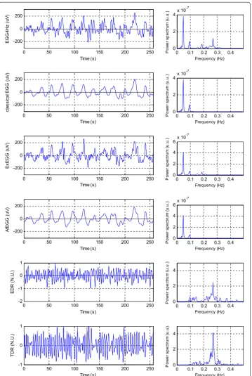 Figure 15 Processed signals and theirs spectra. From top: preprocessed EGG4 Hz (0.15–0.5 Hz) signal (filtering and its spectrum, AfEGG (0.015–0.15 Hz) and its spectrum, derived respiration signal (EDR) and its left) and its spectrum (right), classical EGG 