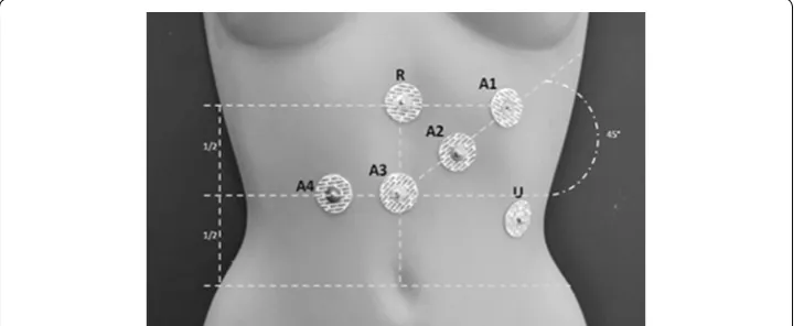Figure 1 The standard placement of the EGG electrodes.