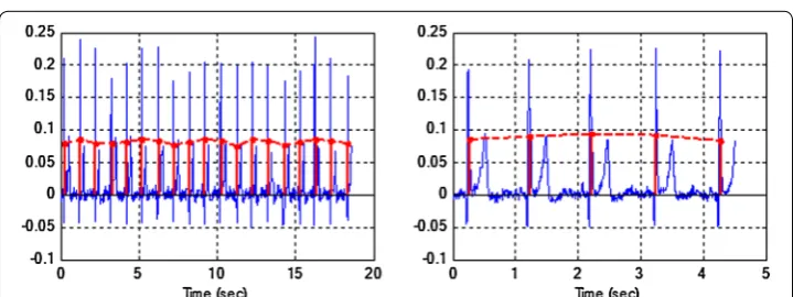 Figure 4 The method of a(j) parameter evaluation of the QRS complex. The black vertical line is an example of normalized area under QRS complex (a(j)) calculated according to formula (1).