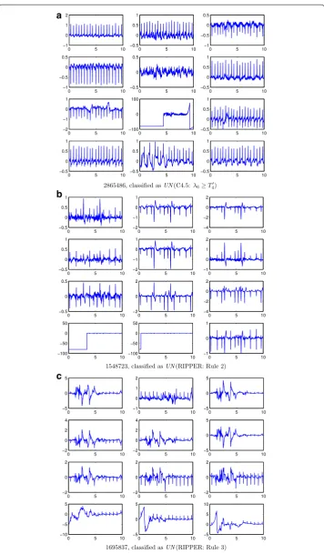 Figure 7 ACAC ECG records wrongly classified by the classifiers (a–c). This corresponds to ECG signals labelled as  that have been classified as UN by the algorithms
