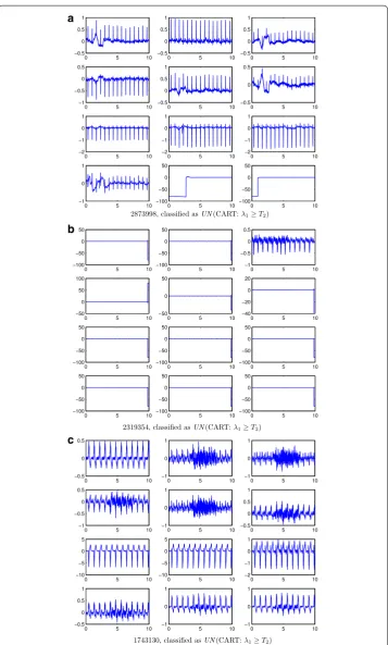 Figure 8 AC ECG records wrongly classified by the classifiers (a–c). This corresponds to ECG signals labelled as AC that have been classified as UN by the algorithms