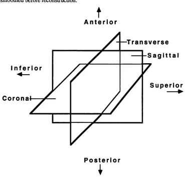 Figure 1.1: Orientation of the three main tomographic planes.