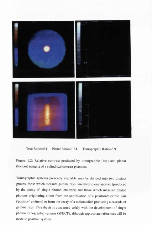 Figure 1.2: Relative contrast produced by tomographic (top) and planar 