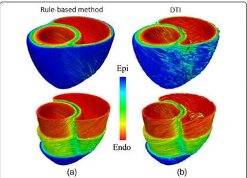 Figure 7 Different methods to include the fibre orientation in 3D bi-ventricular models