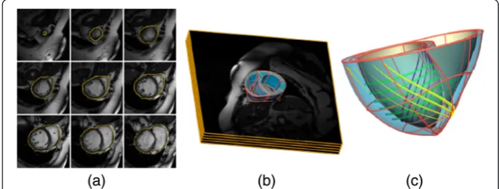 Figure 1 Patient-specific bi-ventricular model.and endocardium (Hermite elements showing the main direction of fibre orientation at epicardium ( (a) In-vivo cardiac MRI slices showing manually segmentedepicardial contour