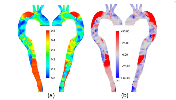 Figure 8 OSI characteristics. (a) OSI distributions for the FSI simulation, (b) Percentage difference in OSIrelative to the rigid wall model.